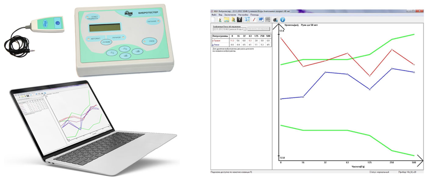 УСТРОЙСТВО ДЛЯ ИССЛЕДОВАНИЯ ВИБРАЦИОННОЙ ЧУВСТВИТЕЛЬНОСТИ  ВТ-02-1-«ВИБРОТЕСТЕР-МБН»