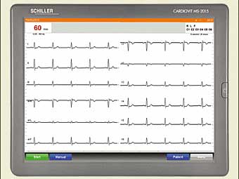 Электрокардиограф Schiller CARDIOVIT MS-2015